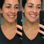 Happy Smile Pro Ingredients